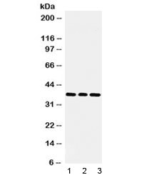 Polyclonal Rabbit anti-Human LDHB / Lactate Dehydrogenase B Antibody (IHC, WB)