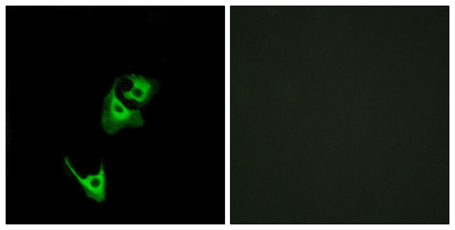 Polyclonal Rabbit anti-Human GLP1R / GLP-1 Receptor Antibody (IF)