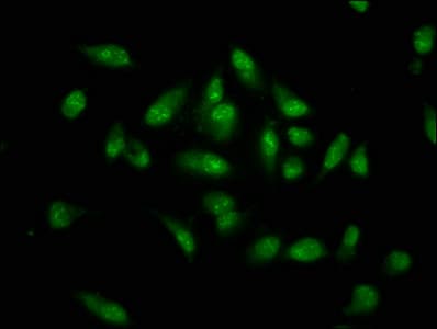 Polyclonal Rabbit anti-Human MKX Antibody (IHC, IF, WB)