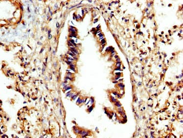 CTSC / Cathepsin C / JP Antibody
