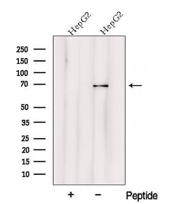 Polyclonal Rabbit anti-Human VPS33A Antibody (WB)