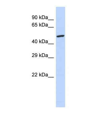 GPD2 Antibody (aa156-205)