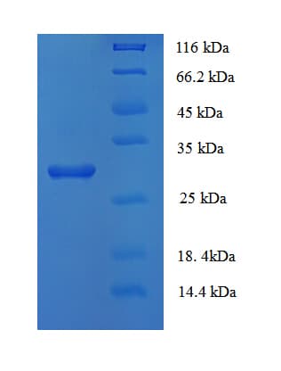 Human HOXB4 Protein (Recombinant His)