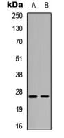 Polyclonal Rabbit anti-Human ARHGDIA / RHOGDI Antibody (C-Terminus, IHC, WB)