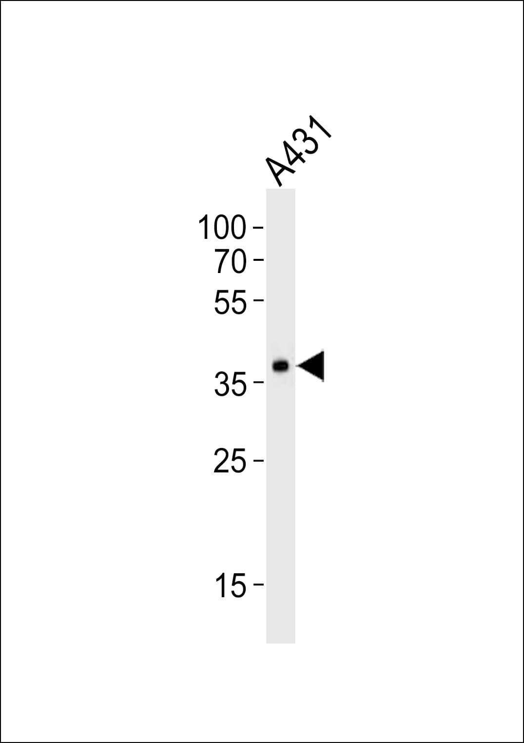 MUL1 / MULAN Antibody (aa176-210)