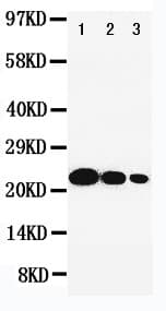 Polyclonal Rabbit anti-Human IL6 / Interleukin 6 Antibody (aa195-212, WB)