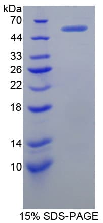 Mouse XRCC5 / Ku80 Protein (Recombinant His-T7)