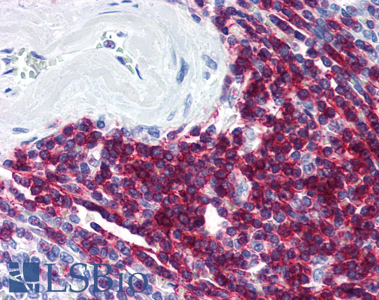 PathPlus™ CD5 Antibody (clone MEM-32)