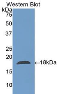 CLC Antibody (aa2-142, APC)