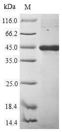 Human gL Protein (Recombinant 10His-SUMO, N-terminus + Myc, C-terminus)