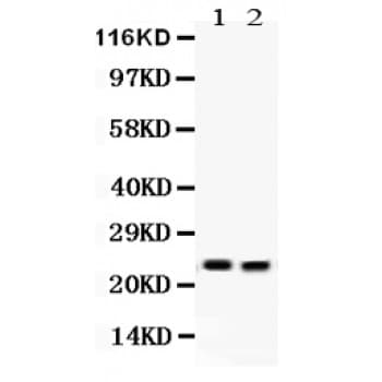 Polyclonal Rabbit anti-Rat LCN2 / Lipocalin 2 / NGAL Antibody (aa21-198, IHC, WB)