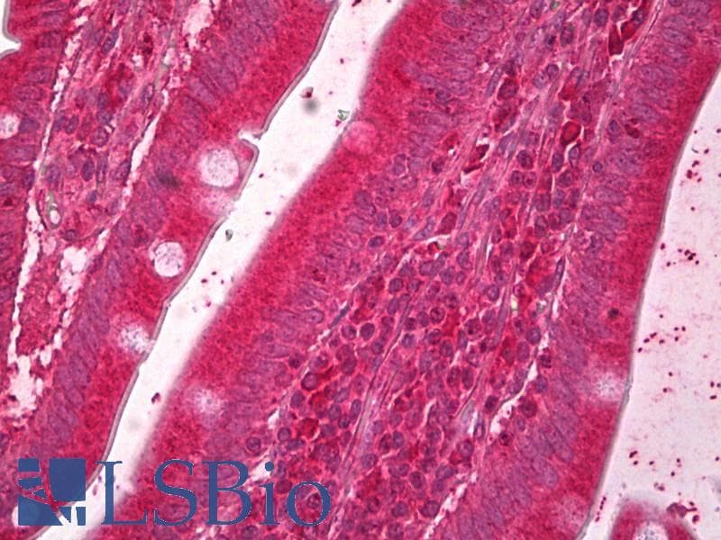 IHC-plus™ ERO1A / ERO1L Antibody (aa105-118)