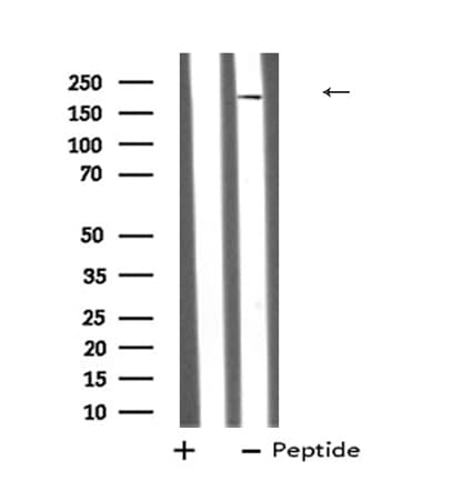 Polyclonal Rabbit anti-Human A2M / Alpha-2-Macroglobulin Antibody (WB)