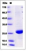 Human CRP / C-Reactive Protein (Recombinant)