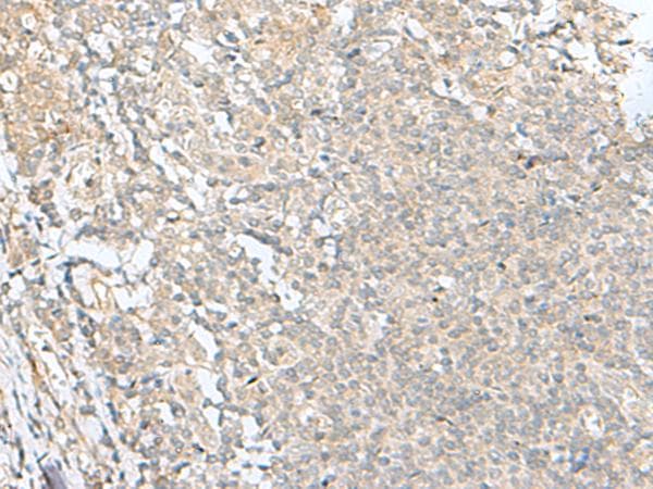 SLC26A3 / DRA Antibody