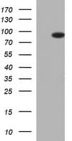 FOXP1 Antibody (clone OTI4D2)