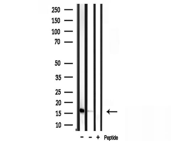 RPL35 / Ribosomal Protein L35 Antibody