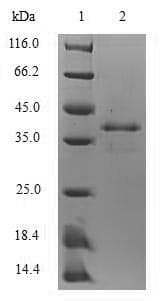 Rat S100A9 / MRP14 Protein (Recombinant 6His-SUMO, N-terminus)
