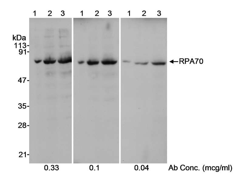 Polyclonal Rabbit anti-Human RPA70 / RPA1 Antibody (aa350-400, IHC, WB)