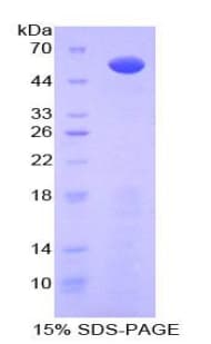 Human GPC3 / Glypican 3 Protein (Recombinant His-GST)