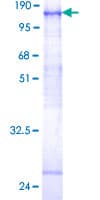 Human FGFR4 Protein (Recombinant GST)