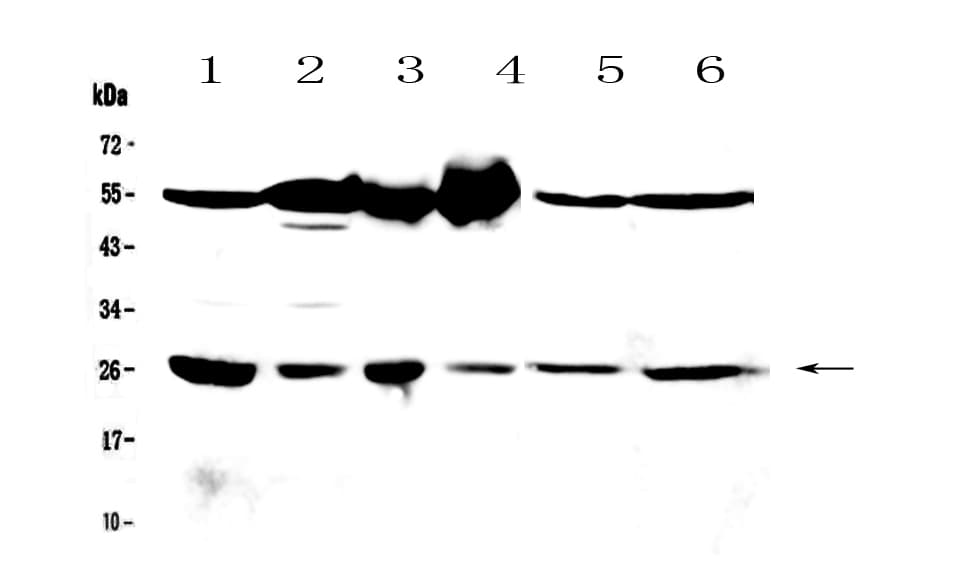 GSTM3 Antibody