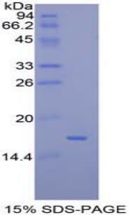 Mouse CCL28 / MEC Protein (Recombinant His-T7)