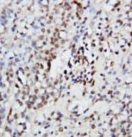 MAPK3 / ERK1 Antibody (aa365-379)