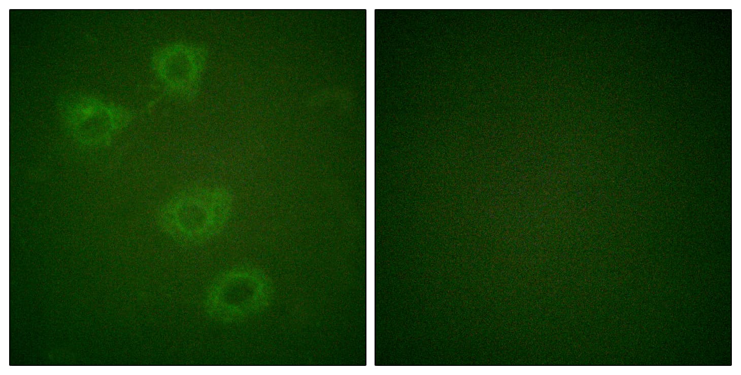 TH / Tyrosine Hydroxylase Antibody (phospho-Ser19)