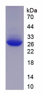 Human KPNA2 / Importin Alpha 1 Protein (Recombinant His-T7)