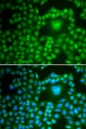 PPP1CB Antibody