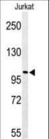Polyclonal Rabbit anti-Human PLEKHH2 Antibody (aa1049-1079, IHC, WB)