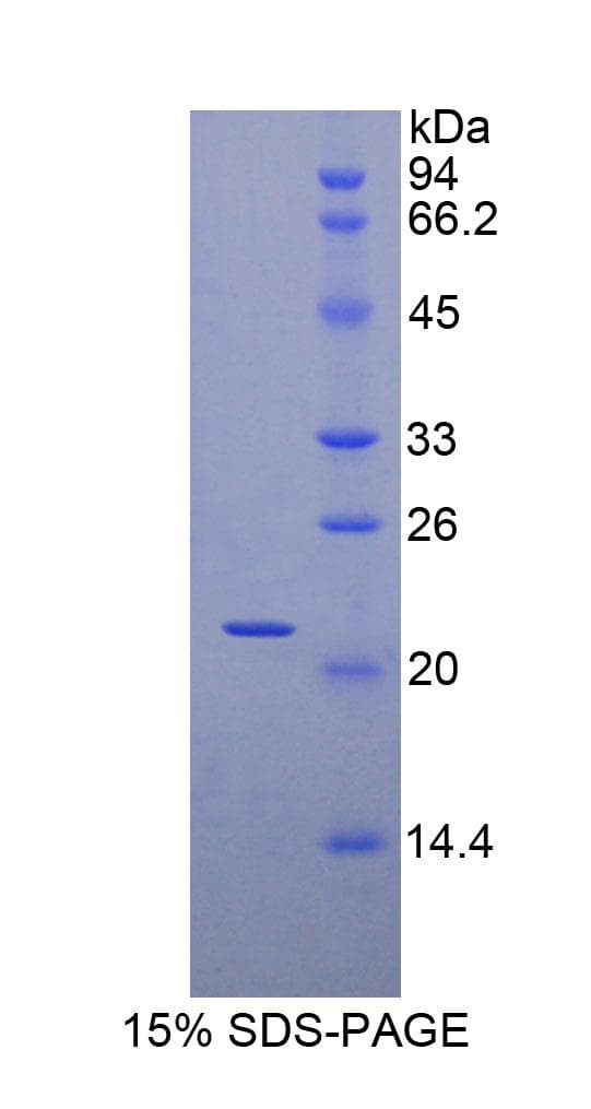 Human MYL3 Protein (Recombinant His, N-Terminal)