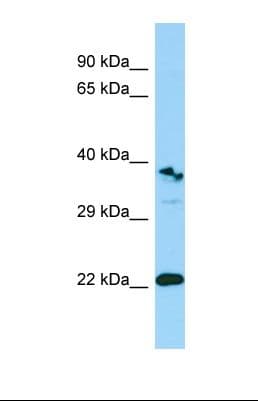 TREML1 / TLT1 Antibody (aa24-73)