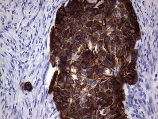IHC-plus™ Acidic Cytokeratin Antibody (clone 1D10)
