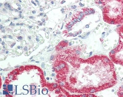 IHC-plus™ G6PC / Glucose-6-Phosphatase Antibody