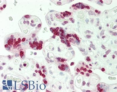 Polyclonal Rabbit anti-Human HIST1H1C Antibody (aa101-150, IHC, WB)