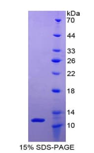 Human CXCL5 Protein (Recombinant His-T7)