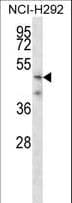 TMPRSS5 Antibody (aa6-35)