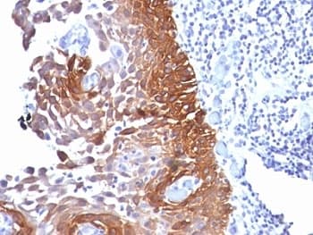 KRT18 / CK18 / Cytokeratin 18 Antibody (clone KRT18 Cocktail)