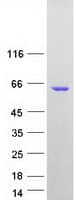 Human IRF5 Protein (Recombinant Myc-DDK (Flag))