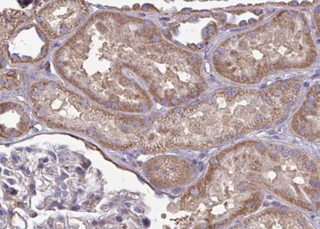 Polyclonal Rabbit anti-Human CYP2J2 Antibody (IHC, IF, WB)