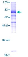 Human SIGIRR Protein (Recombinant GST)