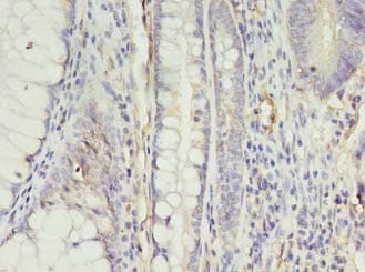 Polyclonal Rabbit anti-Human APLNR/ Apelin Receptor / APJ Antibody (IHC)