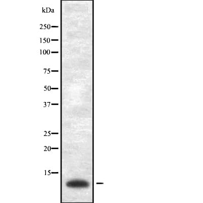 Polyclonal Rabbit anti-Human VAMP1 / VAMP-1 Antibody (IHC, WB)