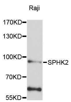 Polyclonal Rabbit anti-Human SPHK2 Antibody (IHC, WB)