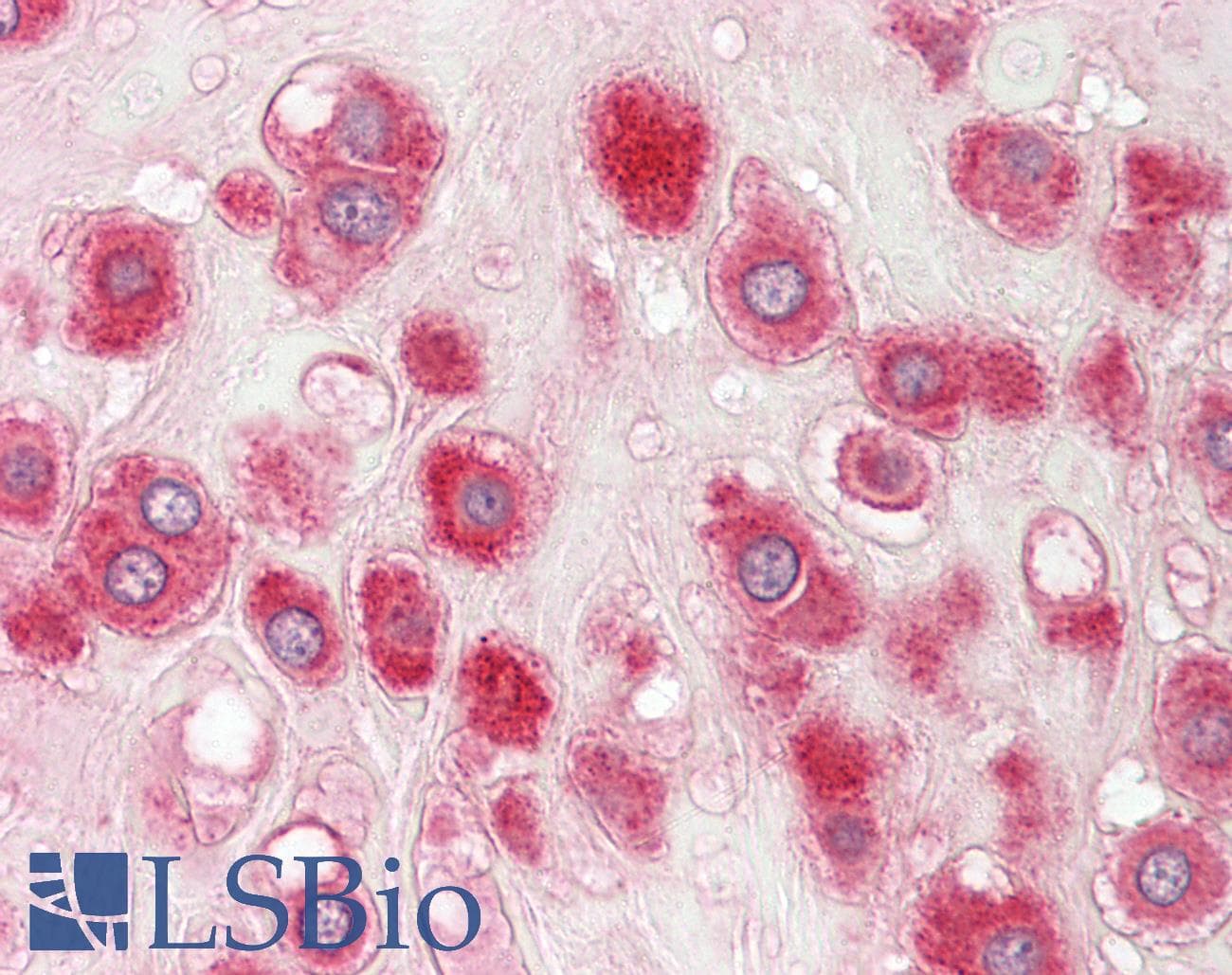 IHC-plus™ RPLP1 Antibody