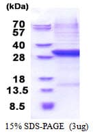 Human CFB / Complement Factor B Protein (Recombinant His)