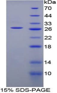 Rat CD244 Protein (Recombinant His-T7)