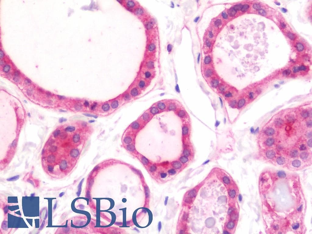 IHC-plus™ NPEPPS Antibody (aa328-648)